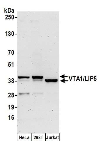 Polyclonal Rabbit anti-Human VTA1 Antibody (aa150-200, WB)