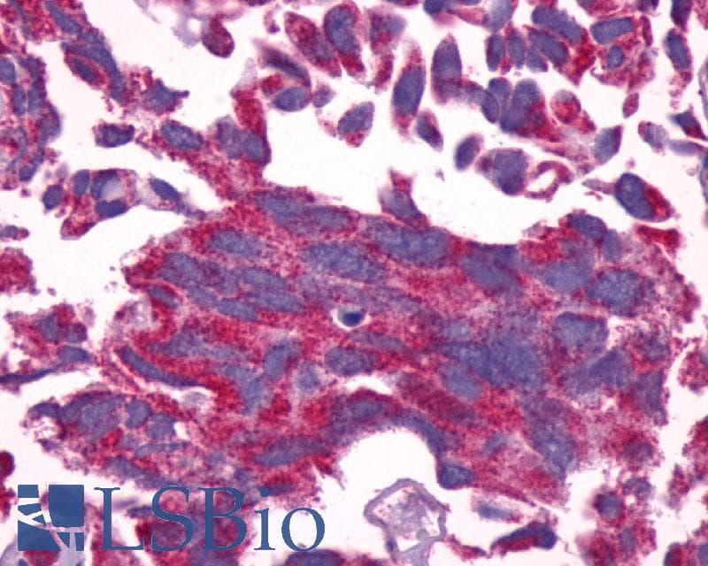IHC-plus™ Polyclonal Rabbit anti-Human GCGR / Glucagon Receptor Antibody (N-Terminus, IHC)