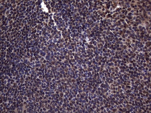 RNF20 Antibody (aa493-754, clone OTI2B9)