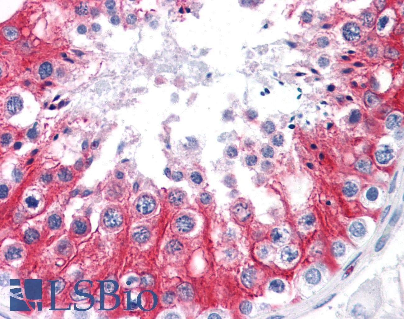 IHC-plus™ Monoclonal Mouse anti-Human GOK / STIM1 Antibody (clone 5A2, IHC, IF, WB)