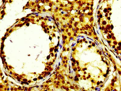 HIST1H2BN Antibody