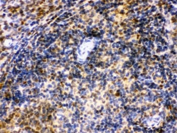 IRF5 Antibody
