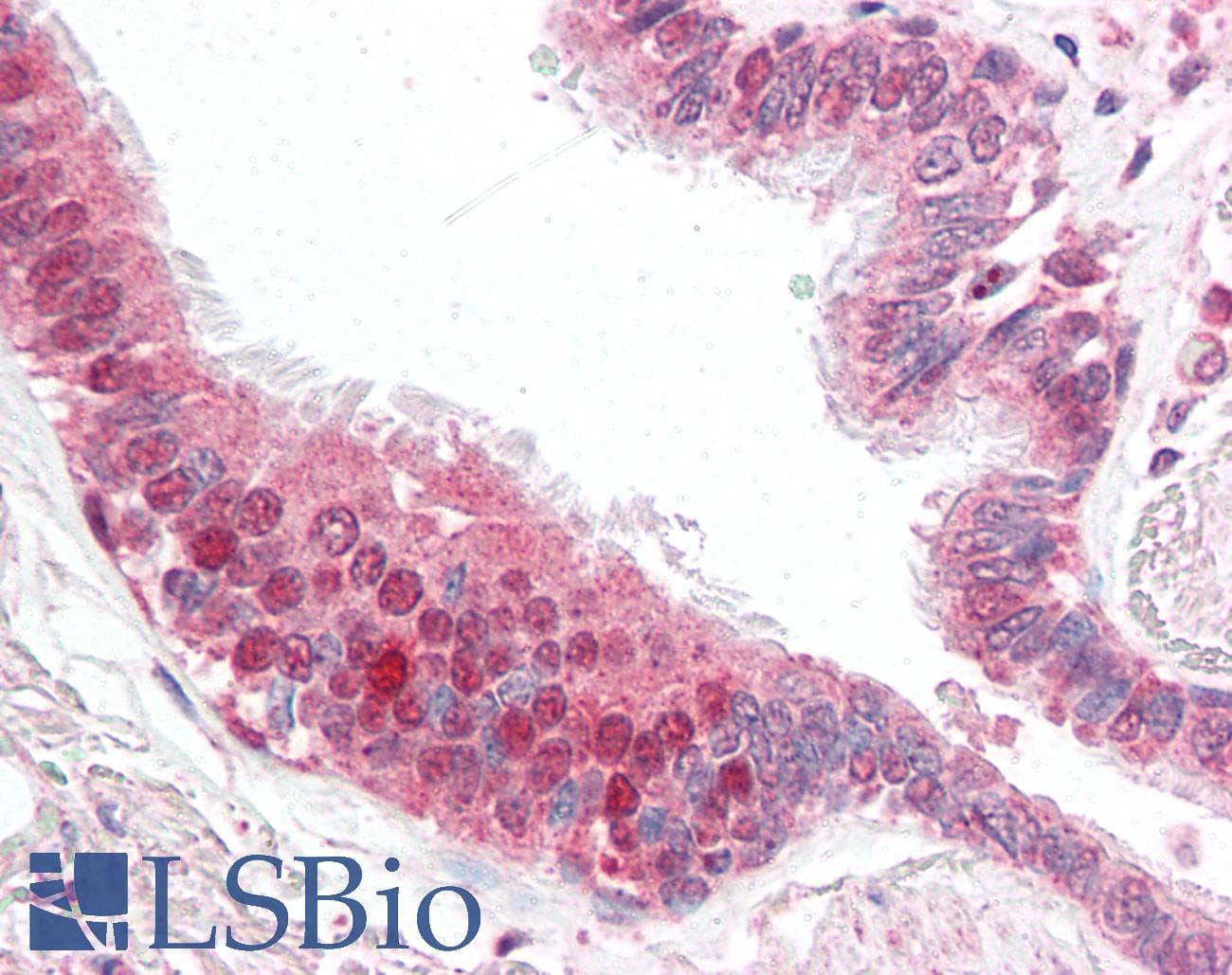IHC-plus™ Polyclonal Rabbit anti-Human CFLAR / FLIP Antibody (IHC, IF, WB)