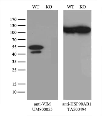 Vimentin Antibody (clone UMAB160, Carrier-free)