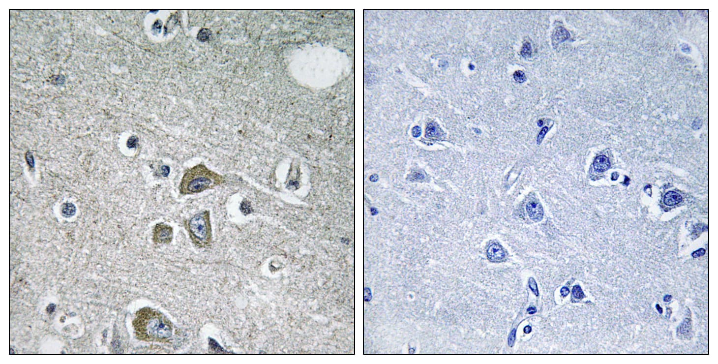 Polyclonal Rabbit anti-Human FBLN2 / Fibulin 2 Antibody (aa241-290, IHC, IF)