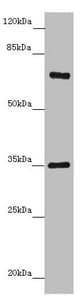 ZNF169 Antibody