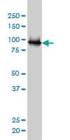 E6AP / UBE3A Antibody (clone 2F6)