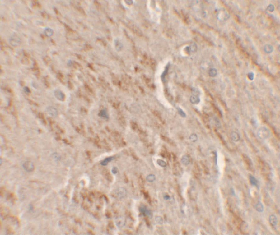 KAT5 / TIP60 Antibody