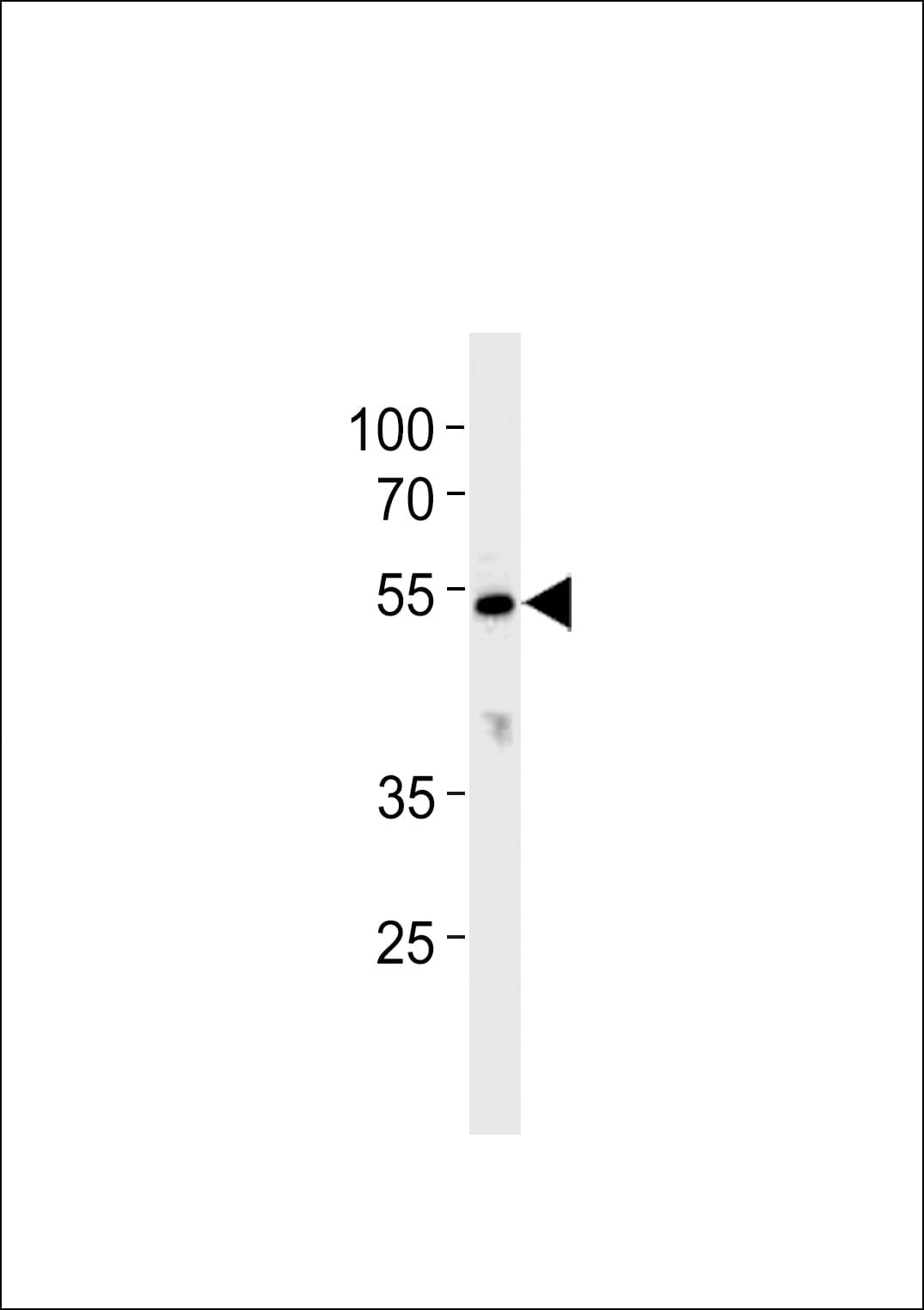 CYP26C1 Antibody (aa410-439)