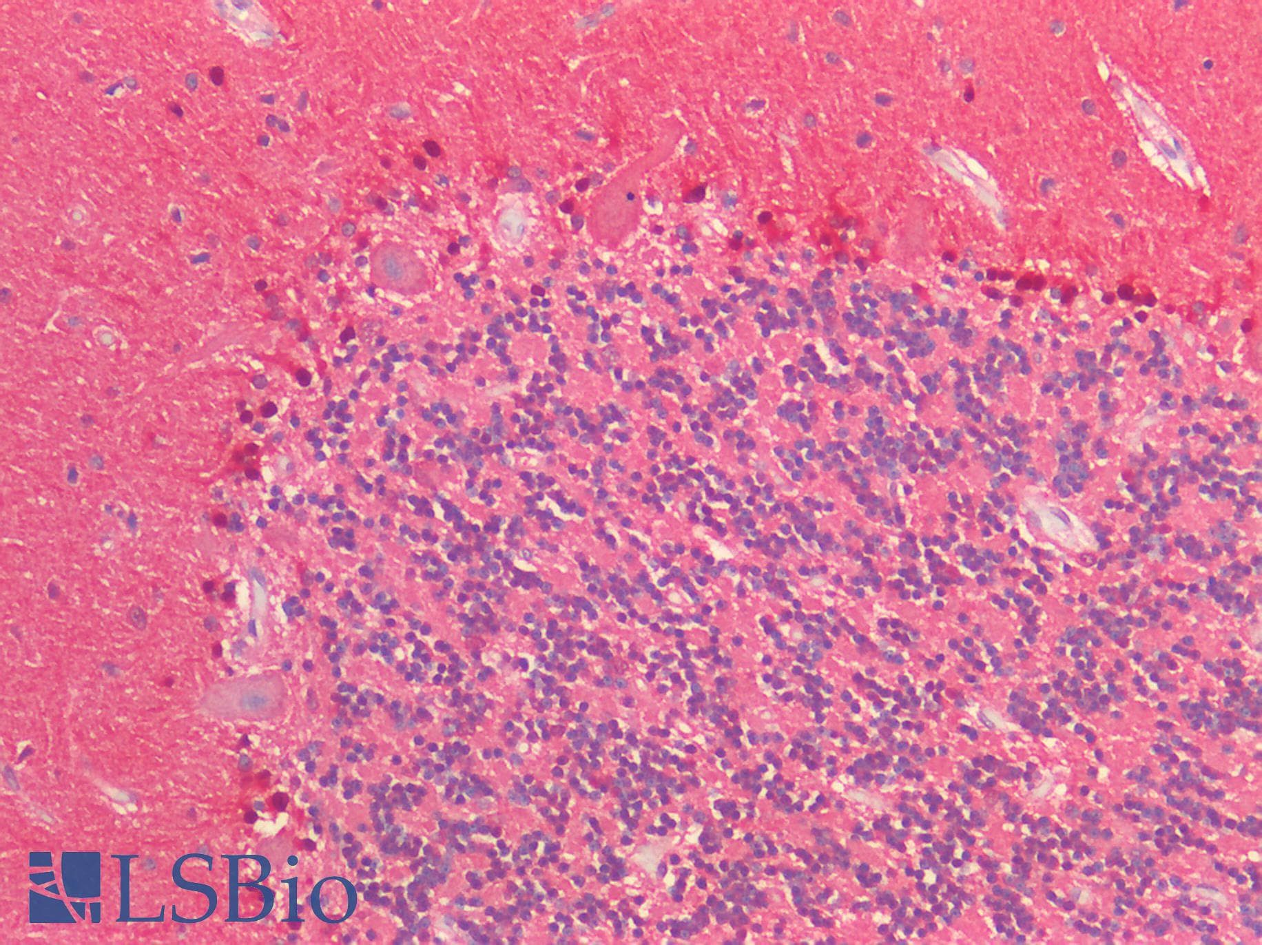 PARK7 / DJ-1 Antibody