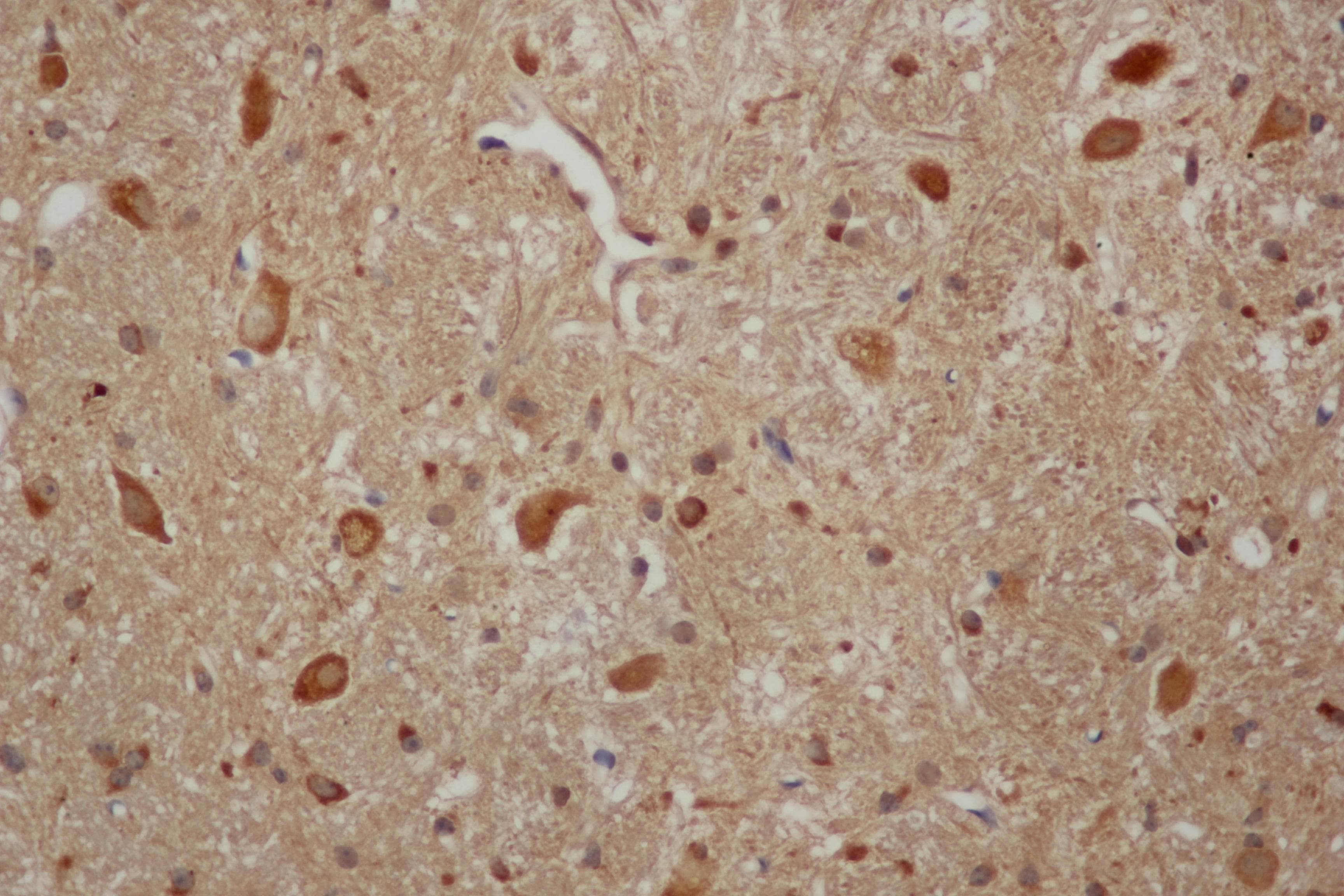 APP / Beta Amyloid Precursor Antibody
