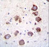 Polyclonal Rabbit anti-Human EGF Antibody (aa690-720, IHC, WB)