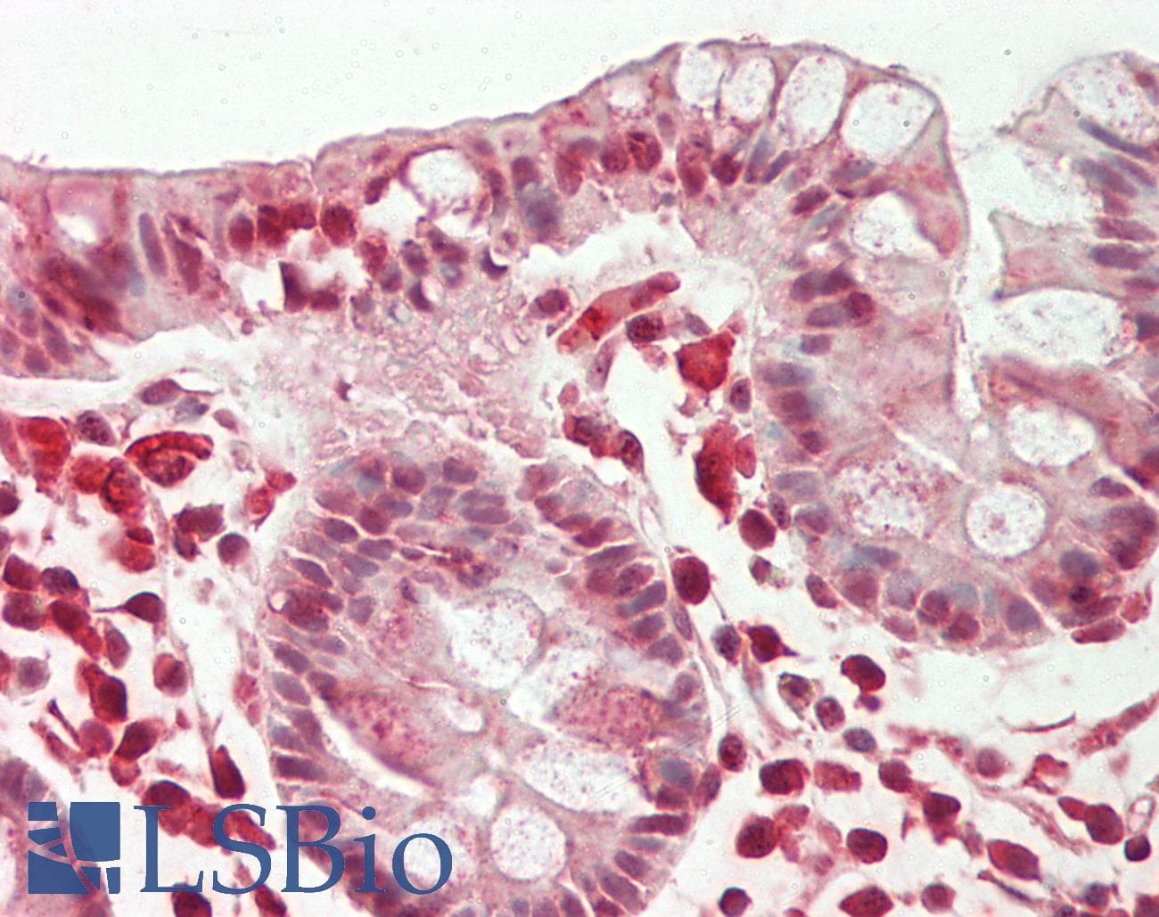 RPL10A Antibody (N-Terminus)