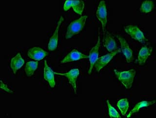 Polyclonal Rabbit anti-Human CO-029 / TSPAN8 Antibody
