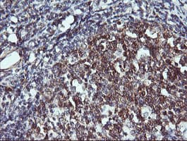 CD45 / LCA Antibody (clone OTI1B7, Carrier-free)