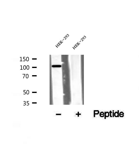 Polyclonal Rabbit anti-Human VPS11 Antibody (IHC, IF, WB)