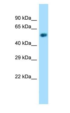 NAPRT Antibody (aa156-205)