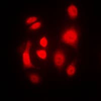 EIF2AK2 / PKR Antibody (C-Terminus)