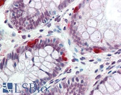 Polyclonal Rabbit anti-Human ANGPTL8 / Betatrophin Antibody (aa24-196, IHC, WB)