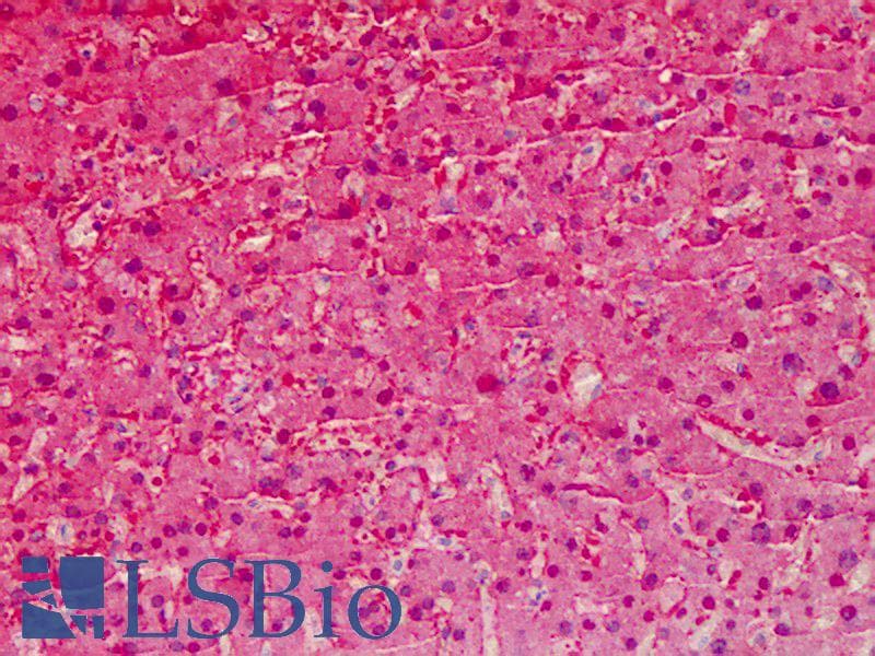IHC-plus™ Polyclonal Rabbit anti-Human ARG1 / Arginase 1 Antibody (IHC, WB)