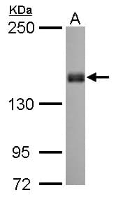 Polyclonal Rabbit anti-Human PPFIA1 / LIPRIN Antibody (aa18-277, WB)