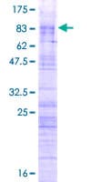 Human ZRSR2 Protein (Recombinant GST)
