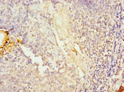 BLOM7 / KIAA0907 Antibody
