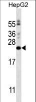 Polyclonal Rabbit anti-Human PIGH Antibody (aa1-30, WB)
