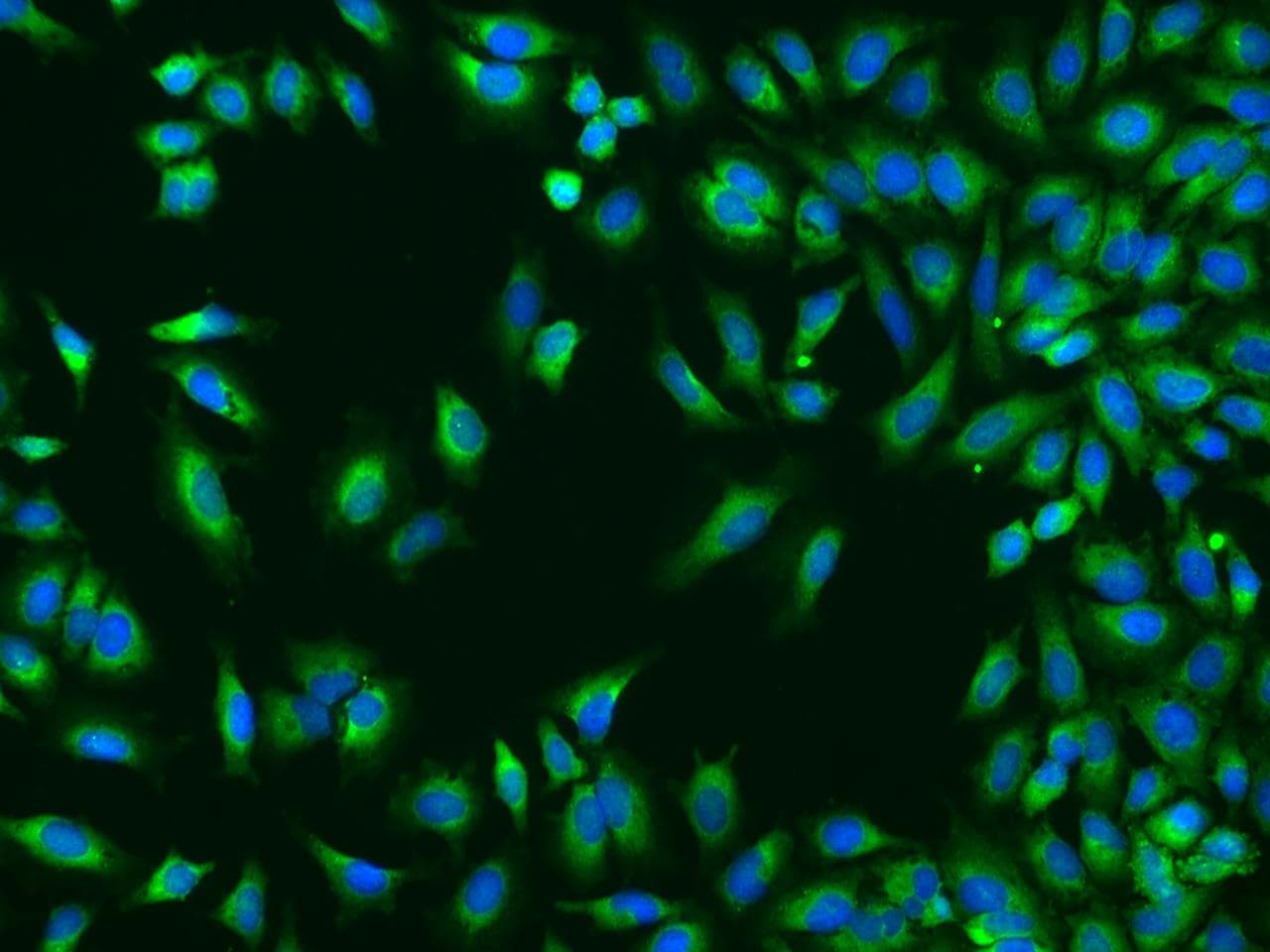 Polyclonal Rabbit anti-Human TROVE2 Antibody (IF, WB)