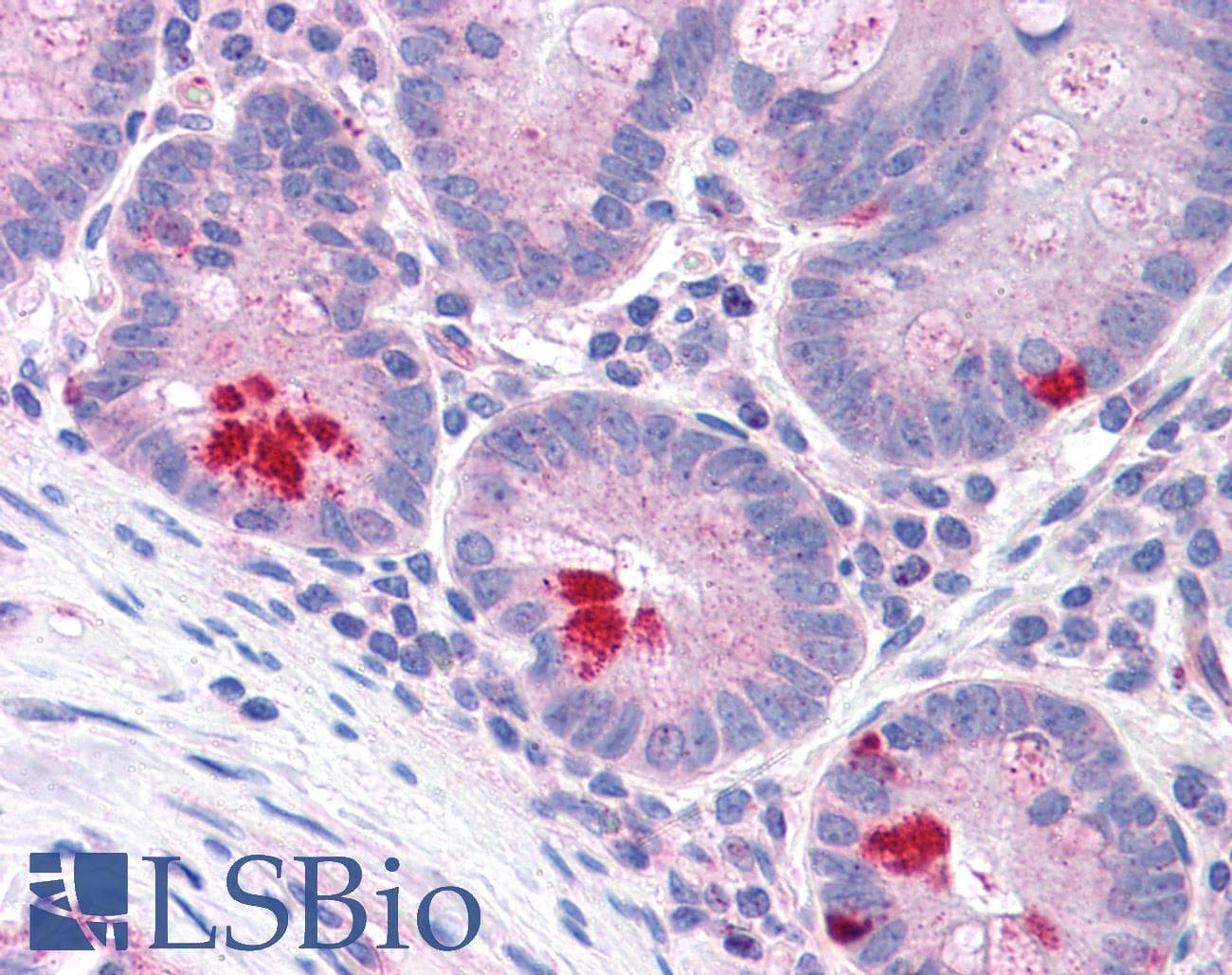 IHC-plus™ LRRN4 / C20orf75 Antibody (Internal)
