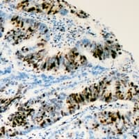 RRS1 Antibody (Internal)
