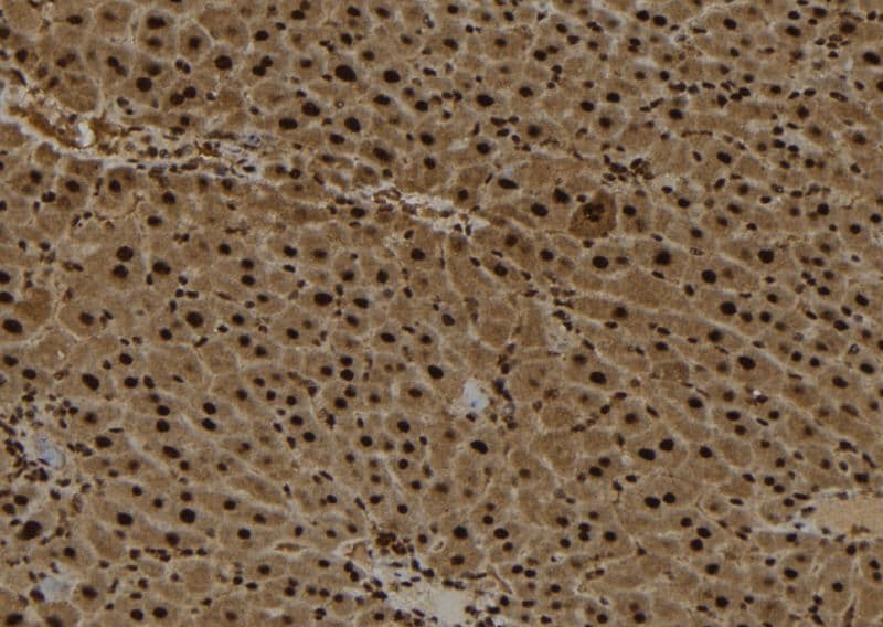 AIMP2 Antibody