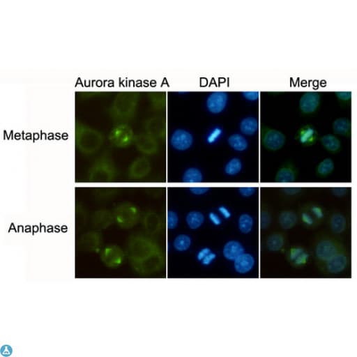 AURKA / Aurora-A Antibody