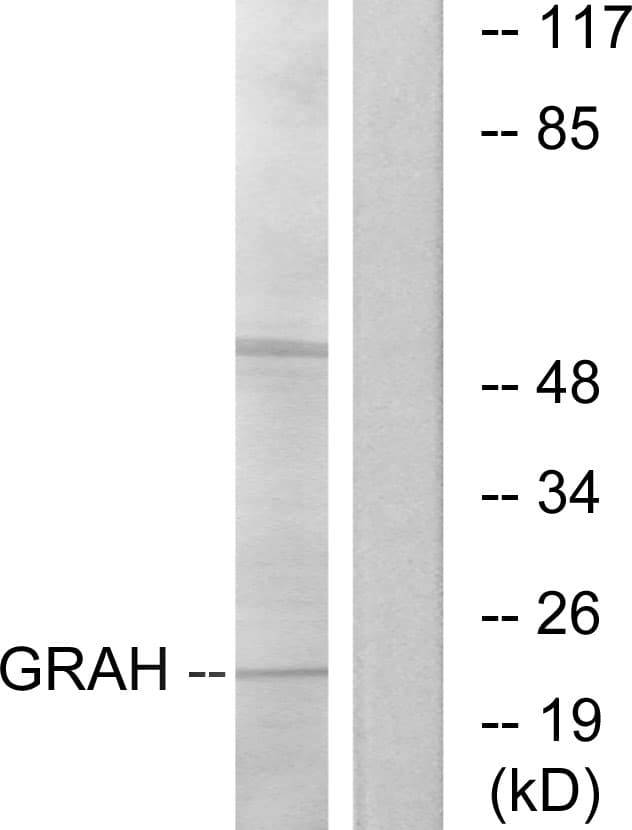 GZMH / Granzyme H Antibody (aa51-100)