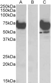 IHC-plus™ EPM2AIP1 Antibody (aa565-579)