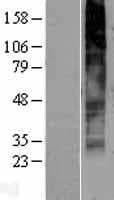 GPR141 Protein (Over-Expression Lysate Myc-DDK (Flag))