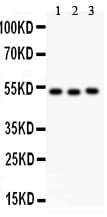Polyclonal Rabbit anti-Human F7 / Factor VII Antibody (aa441-453, WB)