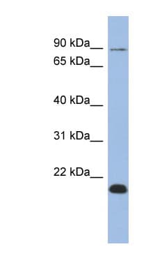 TCEB3B / Elongin A2 Antibody (aa287-336)