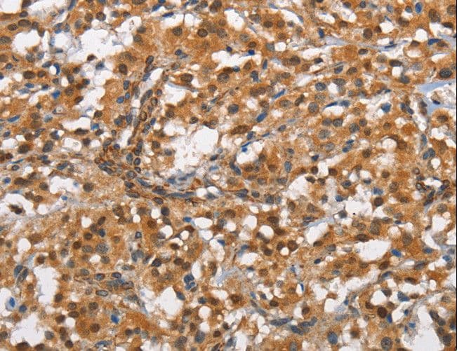 ANPEP / CD13 Antibody