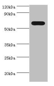 Polyclonal Rabbit anti-Human PAX7 Antibody (aa291-520, IHC, WB)
