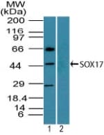 Polyclonal Rabbit anti-Human SOX17 Antibody (aa120-170, WB)