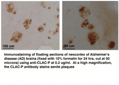 Polyclonal Rabbit anti-Human COL25A1 / Collagen XXV Antibody (aa430-445, IHC, WB)