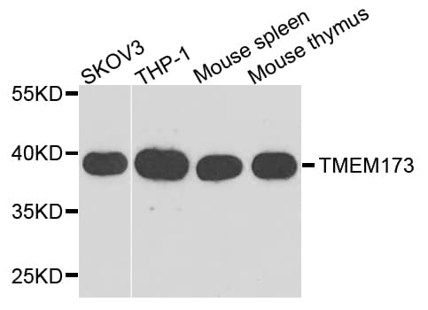 TMEM173 / STING Antibody