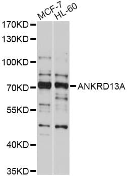 Polyclonal Rabbit anti-Human ANKRD13A Antibody (WB)