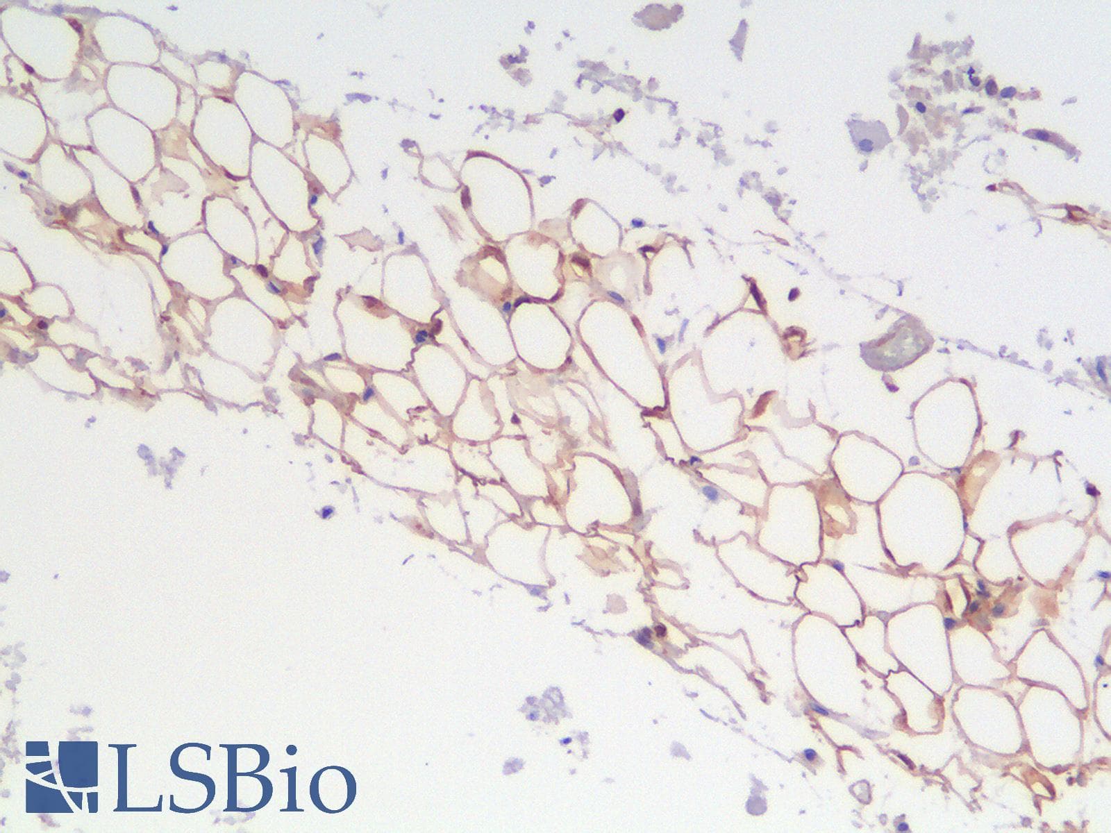 PathPlus™ Recombinant Monoclonal Rabbit anti-Human S100B / S100 Beta Antibody (clone S100B/1706R, IHC)