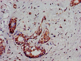 DCLK / DCLK1 Antibody