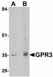 IHC-plus™ Polyclonal Rabbit anti-Human GPR3 Antibody (IHC, IF, WB)