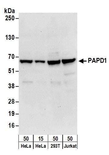 Polyclonal Goat anti-Human SMARCA4 / BRG1 Antibody (aa50-100, IHC, WB)