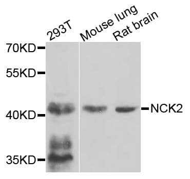 IHC-plus™ Polyclonal Rabbit anti-Human GRB4 / NCK2 Antibody (IHC, WB)
