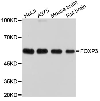 Polyclonal Rabbit anti-Human FOXP3 Antibody (WB)